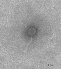Electron Micrograph of the mycobacteriophage Sea Pony (isolated by HON 150/155 students)